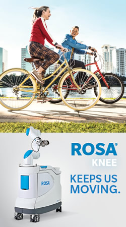 ROSA Knee System Robotic Technology for Total Joint Replacement